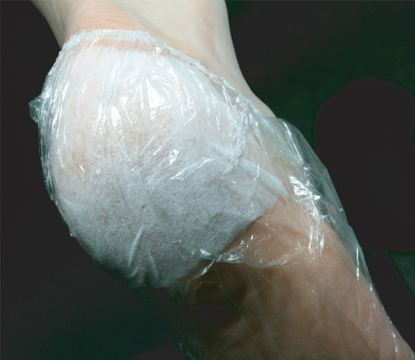 Callus peel skin softner