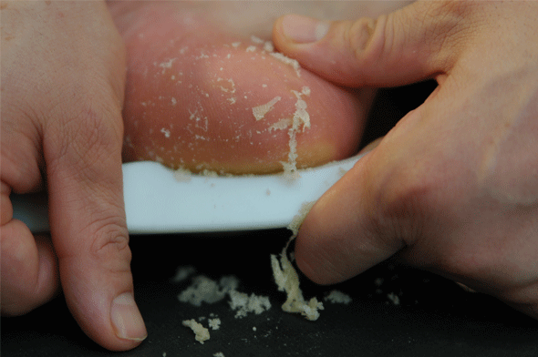 Peel off callus